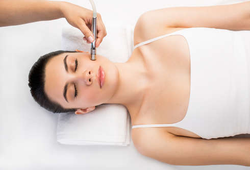 IDEOSPA Wellness treatment Micro-Dermabrasion