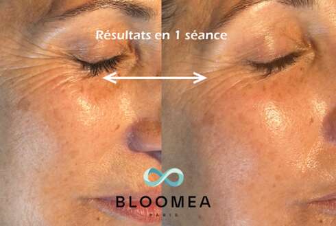 IDEOSPA Wellness treatment GLOW UP découverte
